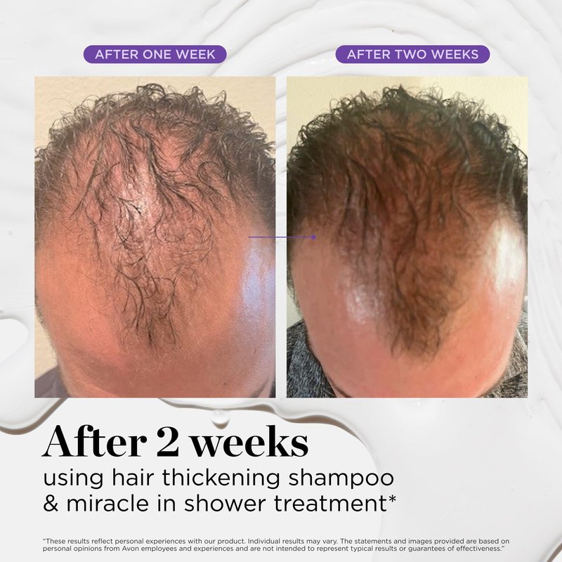 Dr. Groot Miracle in Shower Moisturizing Treatment for Hair Loss, Korean Hair Care Rinse, Rosemary Oil for Smooth, Healthier-Looking Hair in 5 Seconds, Scalp Revitalizing Solution