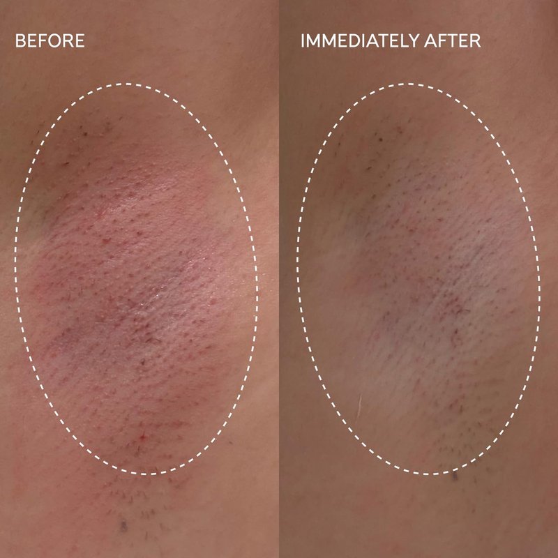 Fur Flash Repair Jelly – Hypochlorous Acid Aftercare Gel for Post-Wax, Shave, or Laser – Soothes Redness, Bumps, and Irritation Dermatologist-Tested, Fragrance-Free (2.0 fl oz / 60mL)
