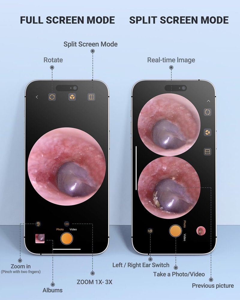 AnyScope HD Digital Otoscope, Video Ear Scope Otoscope with Light, Ultra Clear View Ear Camera with Ear Wax Removal Tools, Compatible with iPhone and Android Devices (Silver) ﻿