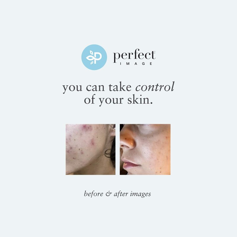 Tri-Clarity Peel Pads, Enhanced with Salicylic Acid, Mandelic Acid, Tea Tree Oil, Green Tea Extract (25% Strength Level)