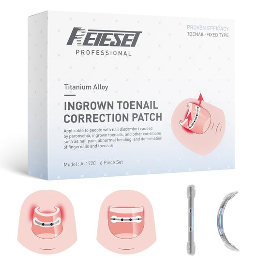 Reieset Titanium Alloy Ingrown Toenail Treatment, Nail Tools, and Ingrown Toenail Removal Kit Specially Designed for Curved Nail Repair and Ingrown Toenail Corrector (0.59/0.67in)