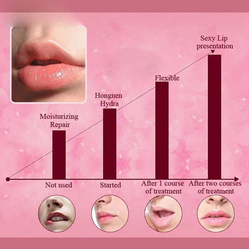 Felico 30Pcs Lip Mask Under Eye Masks Patches,Crystal Collagen Hydrating Moisturizing Smoothing Lips Gel Pads for Puffy Eyes Bags,Dark Circles,Puffiness,Fine Lines,Wrinkles,Anti-Aging Red Pomegranate