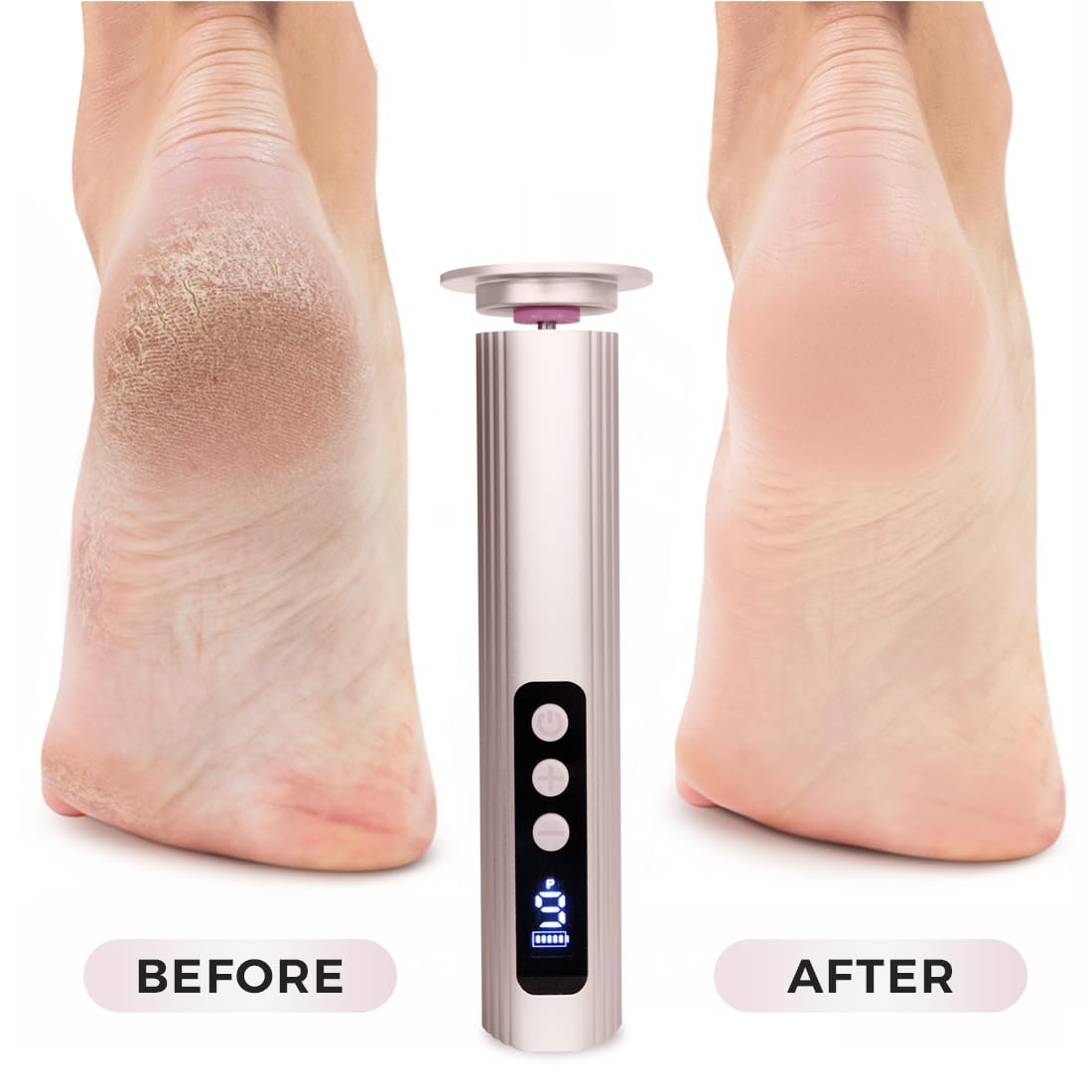Electric Foot Callus Remover with Nano Glass Head, 9-Speed Rechargeable Foot File with Adjustable R/F Rotation, Digital Display & Powerful Motor for Cracked Heels & Dead Skin (Gray)
