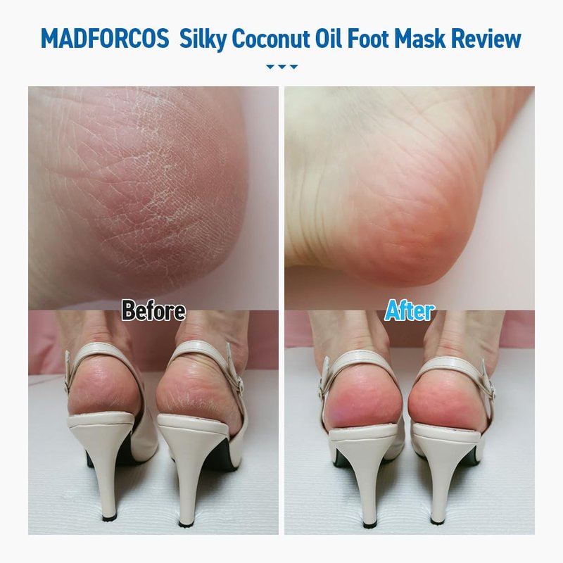 MADFORCOS Moisturizing Foot Mask Socks – Silky Coconut Oil Booties for Dry, Cracked Feet & Heels | 10 Pairs