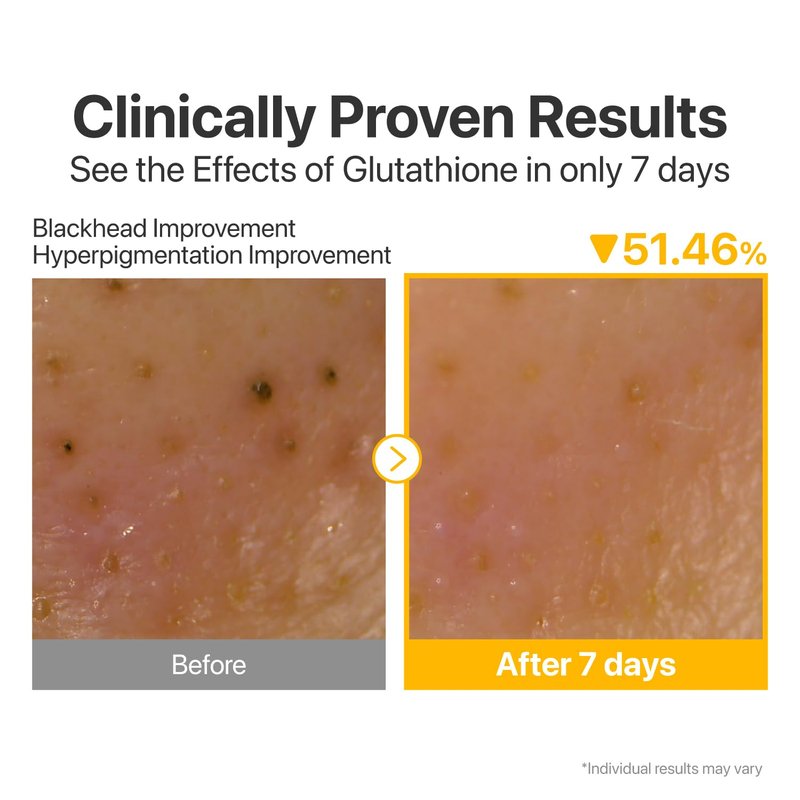 Numbuzin No.5 Cleansing Oil - Glutathione & Vitamin C for Pores, Dark Spots | 6.76 fl oz