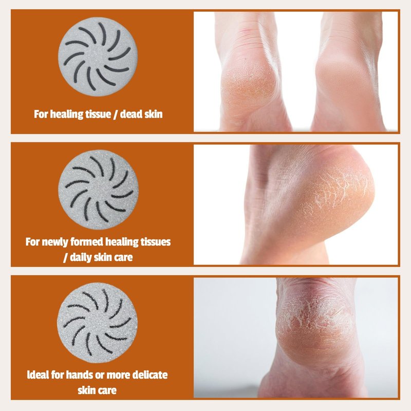 Meyluth Electric Foot Scrubber File Callus Remover with Absorb Function, Waterproof Foot Grinder Cracked Dry Dead Skin Removal for Feet Care, 3 Rollers, 2 Speed, Battery Display