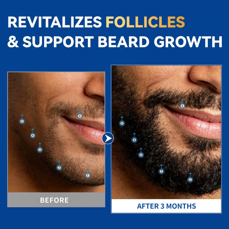 Minoxidil Beard Growth Oil: Minoxidil For Men Beard Infused With Biotin, Extra Strength Minoxidil 5% Beard Growth Serum to Grow Beard & Mustache Fast