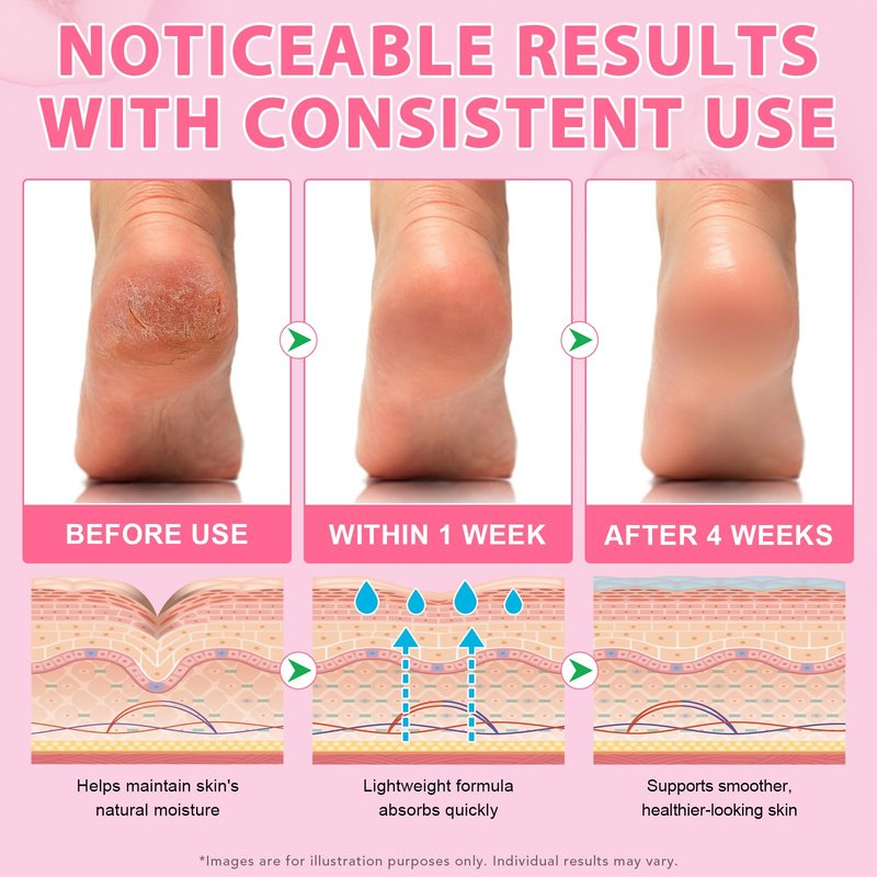 Urea Cream 60% Plus Salicylic Acid 2% Intensive Foot Repair Balm Stick for Dry Cracked/Chapped Heel/Hands Intensively Moisturization, Callus Removal/Softening/Soothing-Peach Scent|1.41 Oz/40 G
