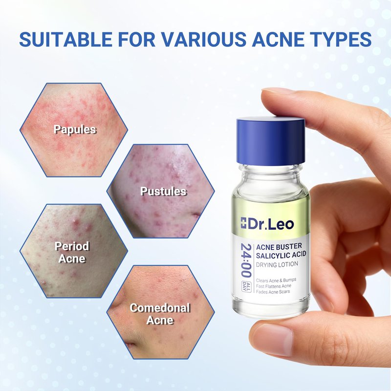 Salicylic Acid Acne Treatment Drying Lotion