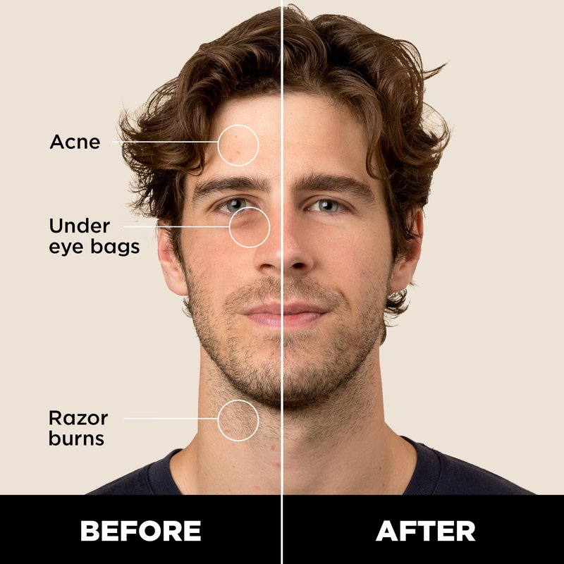 Stryx Concealer Stick Tool for Men, Medium Mahogany - Natural Pigments Hides Imperfections, Acne, Razor Burns, Scars, & Rosacea - Highly Adaptable Shades for Easy, Undetectable Coverage
