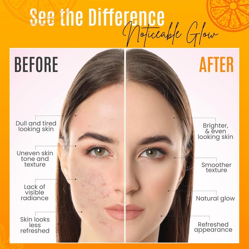 Vitamin C Serum for Face - Organic Anti-Aging Moisturizer with Hyaluronic Acid & Vitamin E | 4 FL OZ