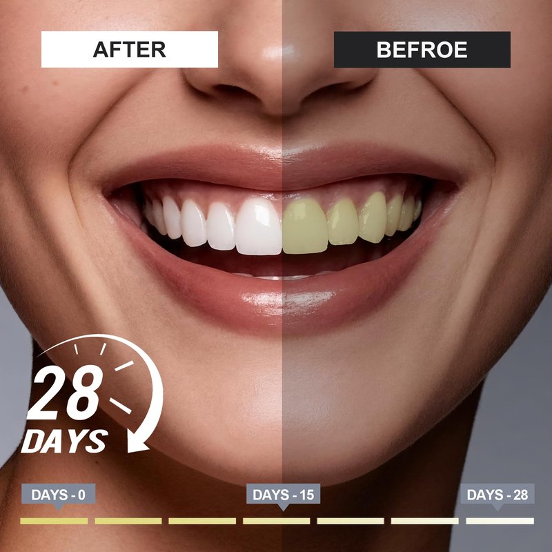 Woadee 7.5% Nano Hydroxyapatite Toothpaste,Fluoride Free,Whitening 3pcs