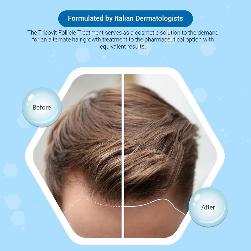 Tricovit Forte Hair Loss Treatment - Hair Growth Products for Women & Men - Sebum Regulator for Strengthening Follicles & Balancing Scalp (5 ct)
