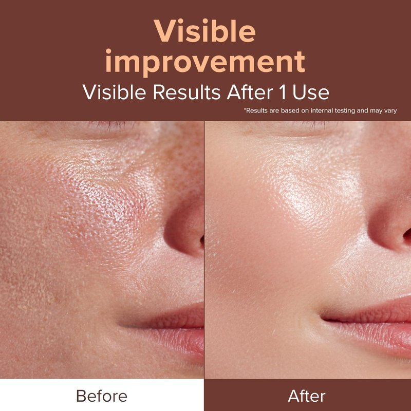 idplacosmetics EXO-V Booster Ampoule 1.01 fl.oz (30ml) – Exosome Serum (720,000 PPM) with PDRN & Glutathione, Korean Skincare Microneedling Serum, for Smoother-Looking Texture & Elasticity Support.