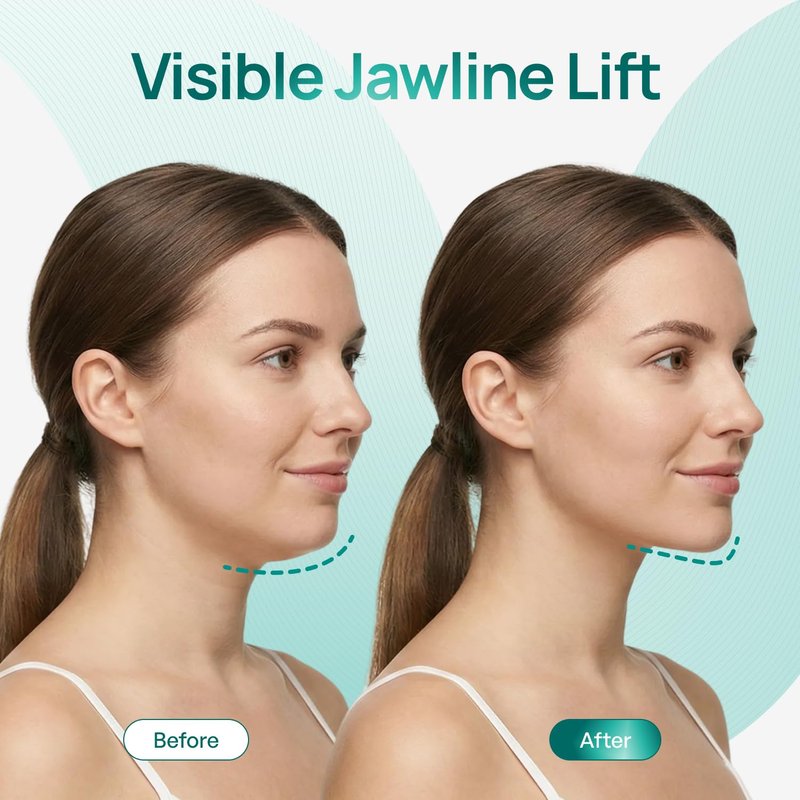PLANTIFIQUE V-Line Chin Lifting Mask with Hyaluronic Acid & Aloe Vera, 20 Pcs - Double Chin Reducer, Jawline Shaper, Neck Firming and Tightening