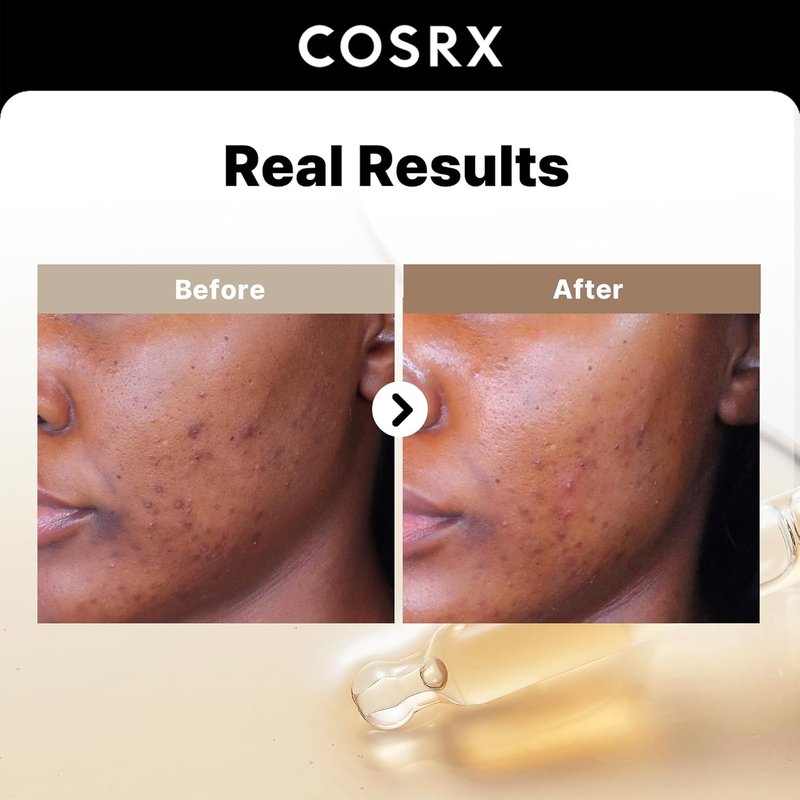 COSRX Spotless Glow Duo - 2% Alpha Arbutin Discoloration Care Serum & Mini Peptide Booster | 1.7 fl. oz + 1 fl. oz