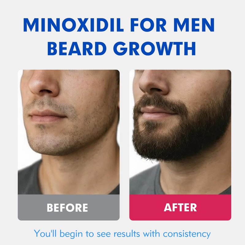5% Minoxidil for Men Hair Regrowth Treatment, Extra Strength Topical Solution for Thinning Hair & Balding, Beard Growth Enhancer, Non-Greasy Fast-Absorbing Formula, 4-Pack (240ml) 4-Month Supply