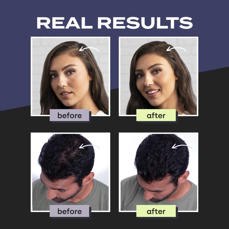 Toppik Hair Building Fibers, Gray, 12g Fill In Fine or Thinning Hair, Instantly Thicker, Fuller Looking, 9 Shades for Men & Women, Keratin Protein Formula