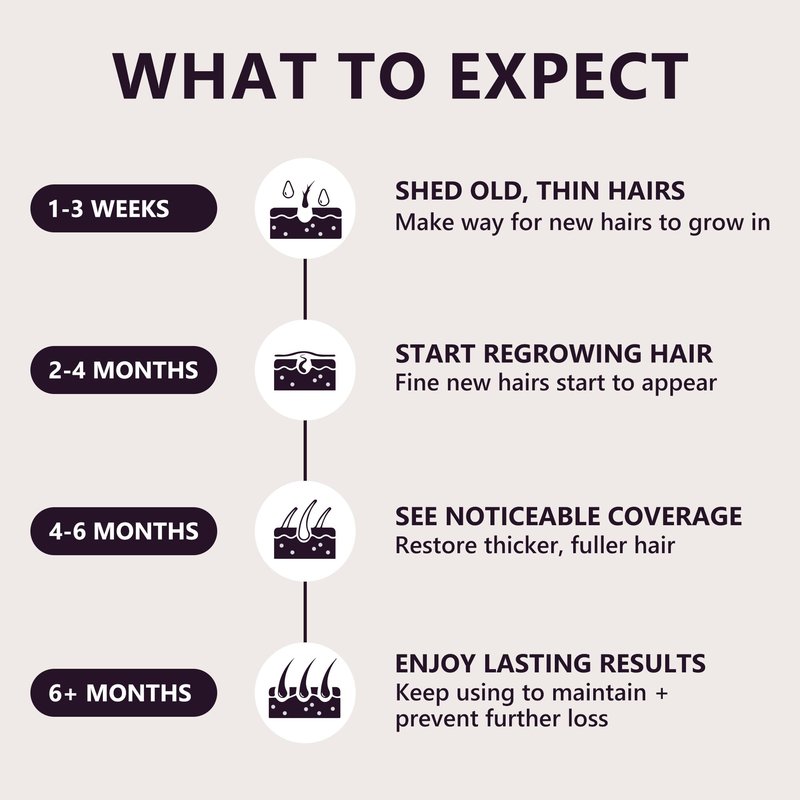 5% Minoxidil Hair Growth Serum for Women: Extra Strength Hair Loss Treatment with Biotin for Thinning Hair - Regrowth Topical Solution - 3 Month Supply