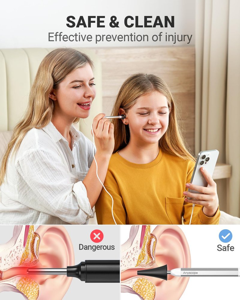 AnyScope HD Digital Otoscope, Video Ear Scope Otoscope with Light, Ultra Clear View Ear Camera with Ear Wax Removal Tools, Compatible with iPhone and Android Devices (Silver) ﻿