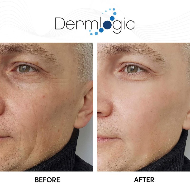 Glycolic Cream 15% - Natural Anti-Aging Exfoliator with A.H.A & Green Tea | Smooth Fine Lines & Dull Skin