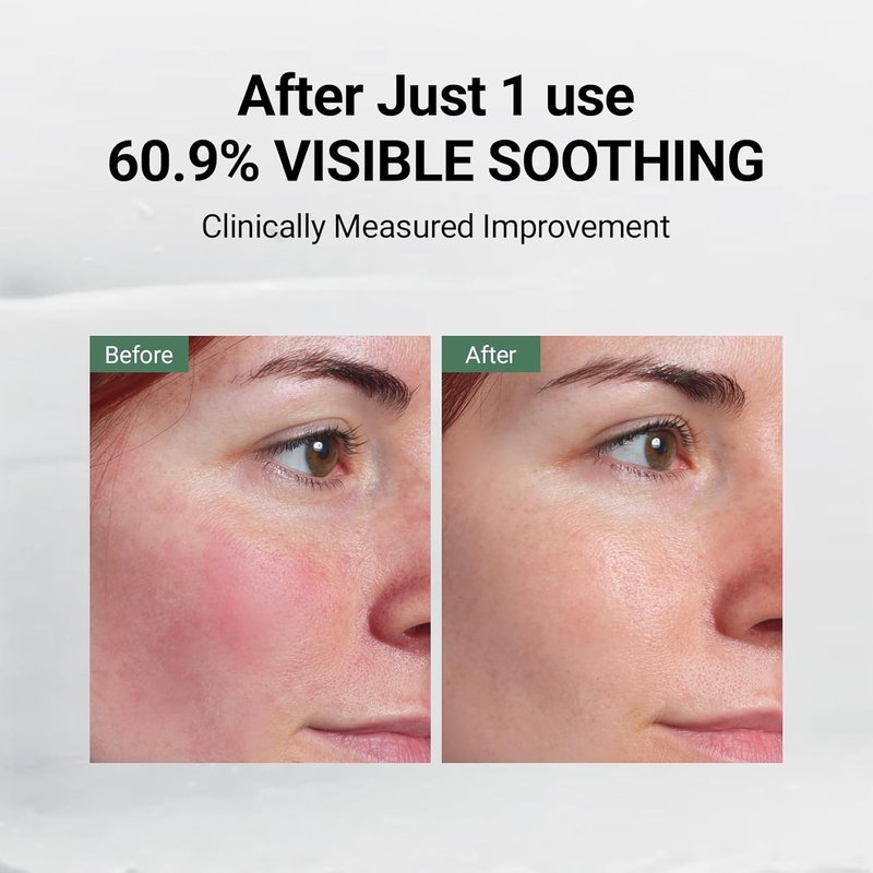 DA EFFECT Post Care Balm - Hydrating Face Moisturizer with TECA & Ginseng Exosome | Soothes Redness & Dryness, 30ml