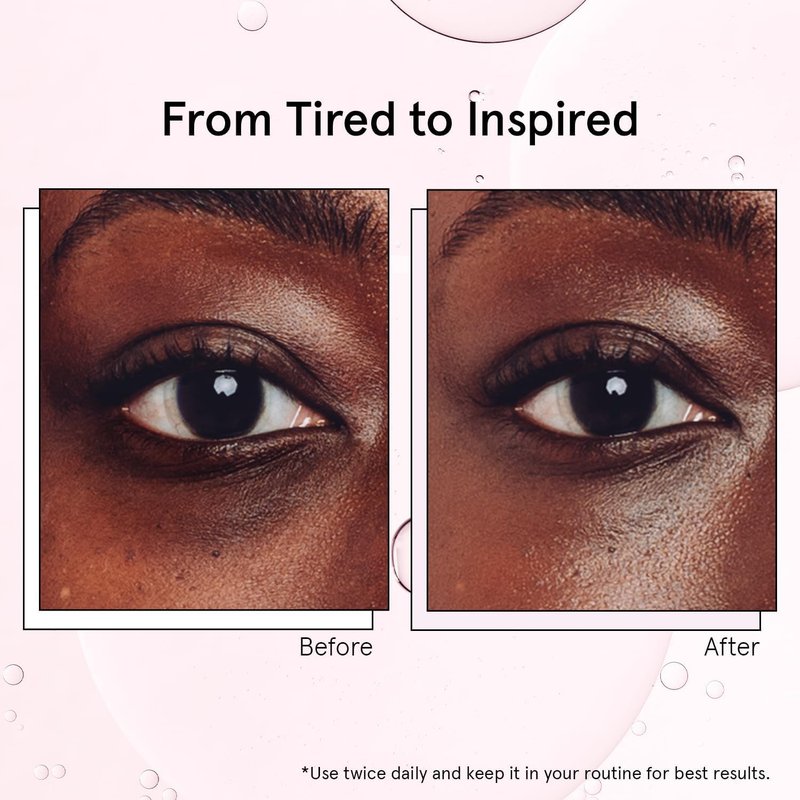 grace & stella Under Eye Brightener with Cooling Metal Rollerball - Centella Asiatica & Caffeine Eye Serum for Puffy Eyes - Travel Essentials - Under Eye Cream - Travel Essentials (15ml / 0.51floz)