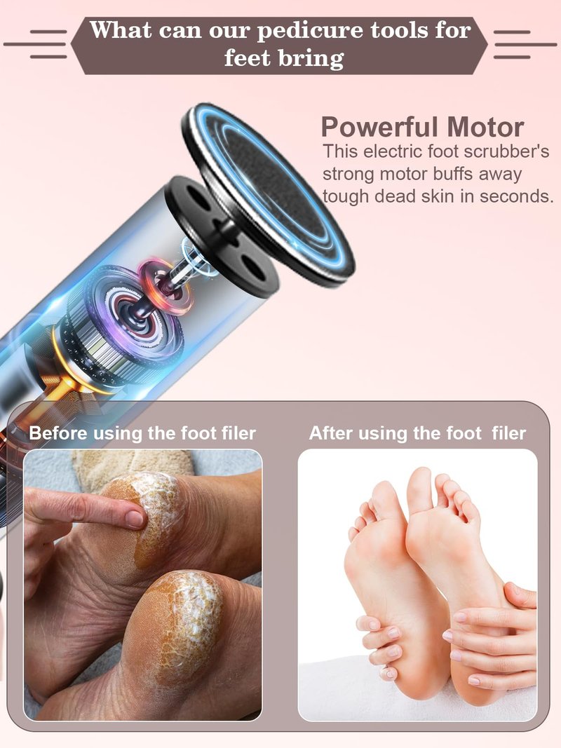 Electric Foot Callus Remover,MOWLIE Electric Foot Care Tools with Speed Controller and 60pcs Replacement Sandpaper Disk for Men Women Dead Dry Crack Skin Calluses (Blue)