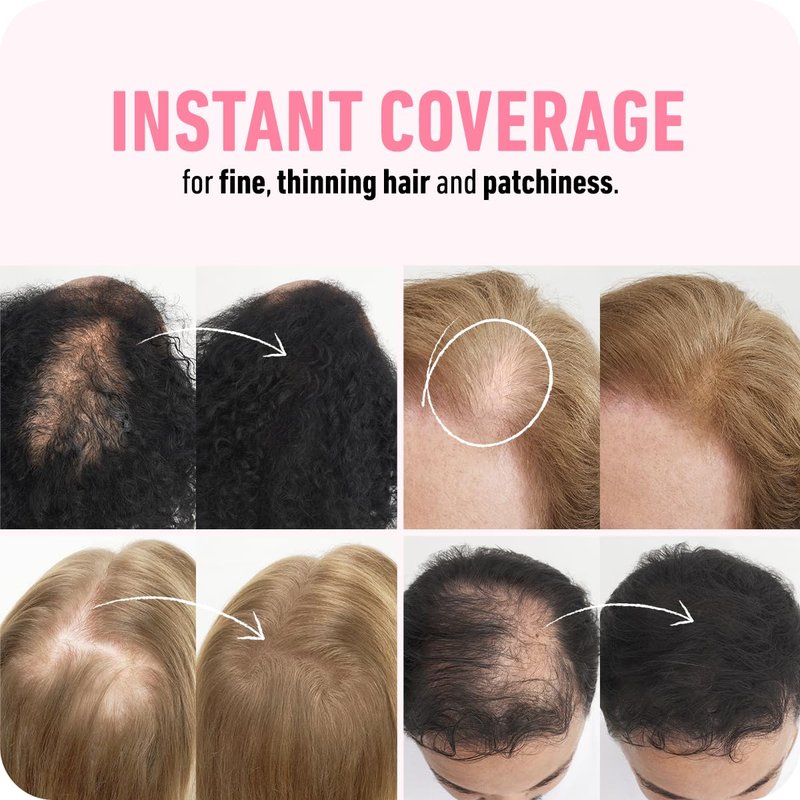 BOLDIFY Hair Fibers (28g) - Fill In Thinning and Fine Hair for an Instantly Fuller, Thicker Look - 14 Shades for Women & Men - Dark Brown