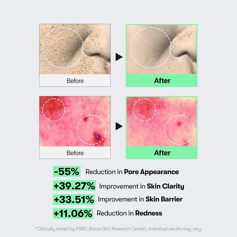 VT COSMETICS CICA Reedle Shot 100, Spicule Microneedling Serum for Pore Care & Exfoliation, Exosome, Centella Asiatica for Glass Skin, Skin Texture, Korean Liquid Skin Booster (1.69 Fl Oz / 50ml)