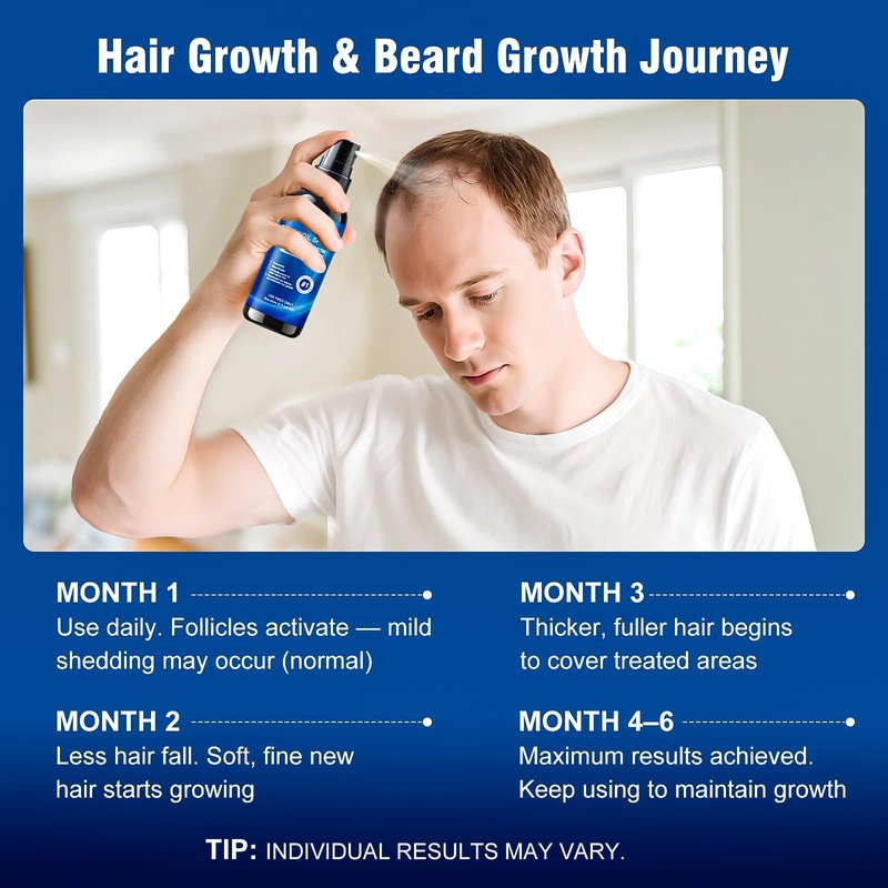 5% Minoxidil Spray for Men and Women,Infused with Biotin, Hair Growth Treatment,Topical hair growth serum,Supports Thicker and Fuller Hair & Beard (6 Pcs,12 Fl Oz Total,6 Month Supply)