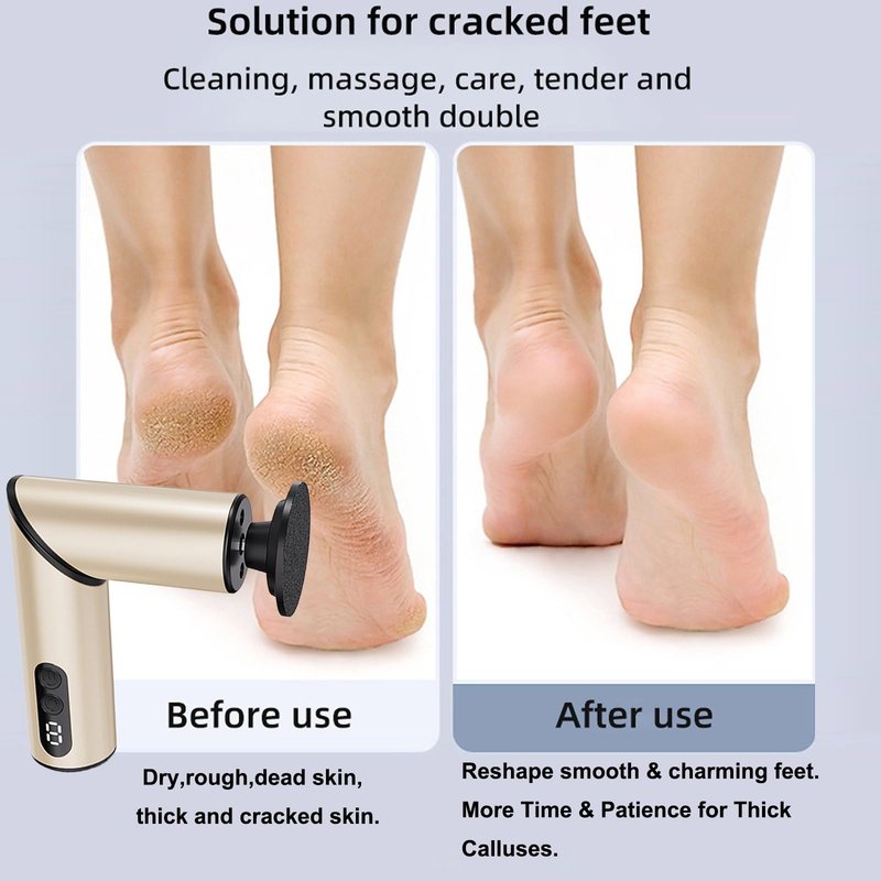 Chu&LiuXung Electric Callus Remover for Feet, Rechargable Fold Electric Foot Callus Remover Tool with Sandpapers,9 Adjustable Speed with Replaceable Grinding Heads for Callus,Cracks and Nails