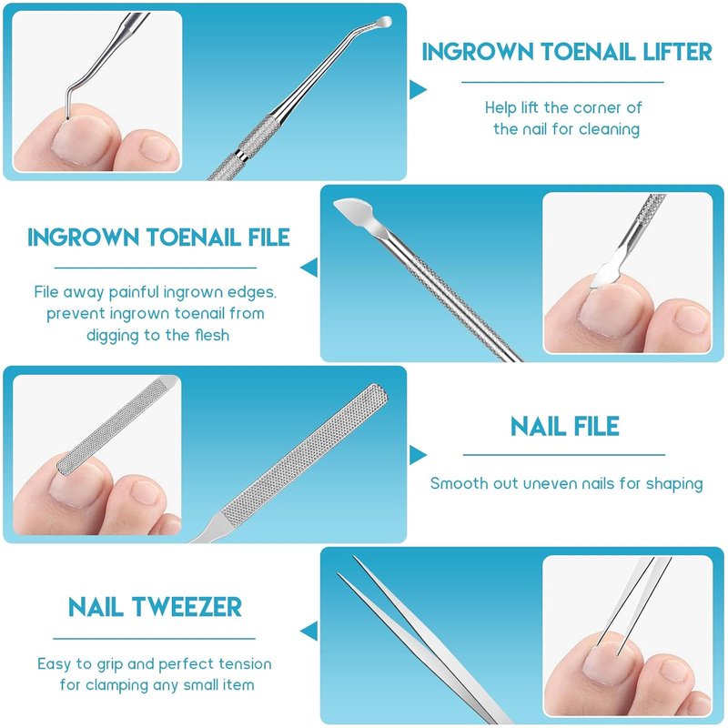 Ingrown Toenail Removal Kit - Professional Tool Set with Corrector Drops, Clipper & Nail File | Complete Pedicure Solution