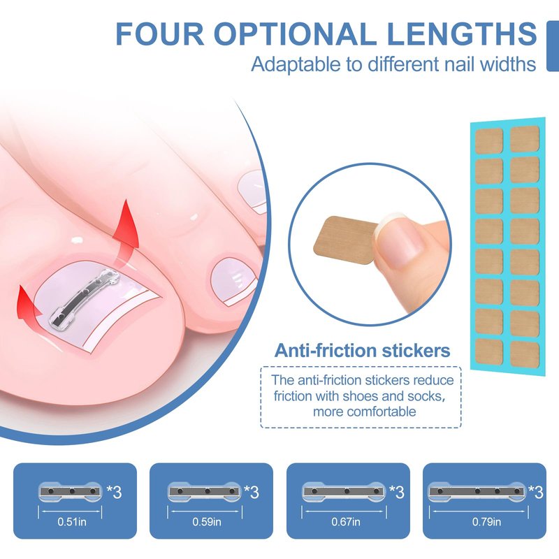 12Pcs Ingrown Toenail Corrector Strips for Curved Toenail Quick Relief,4 Multi-Sizes Ingrown Toenail Treatment Relief Tools Kit for Home Use