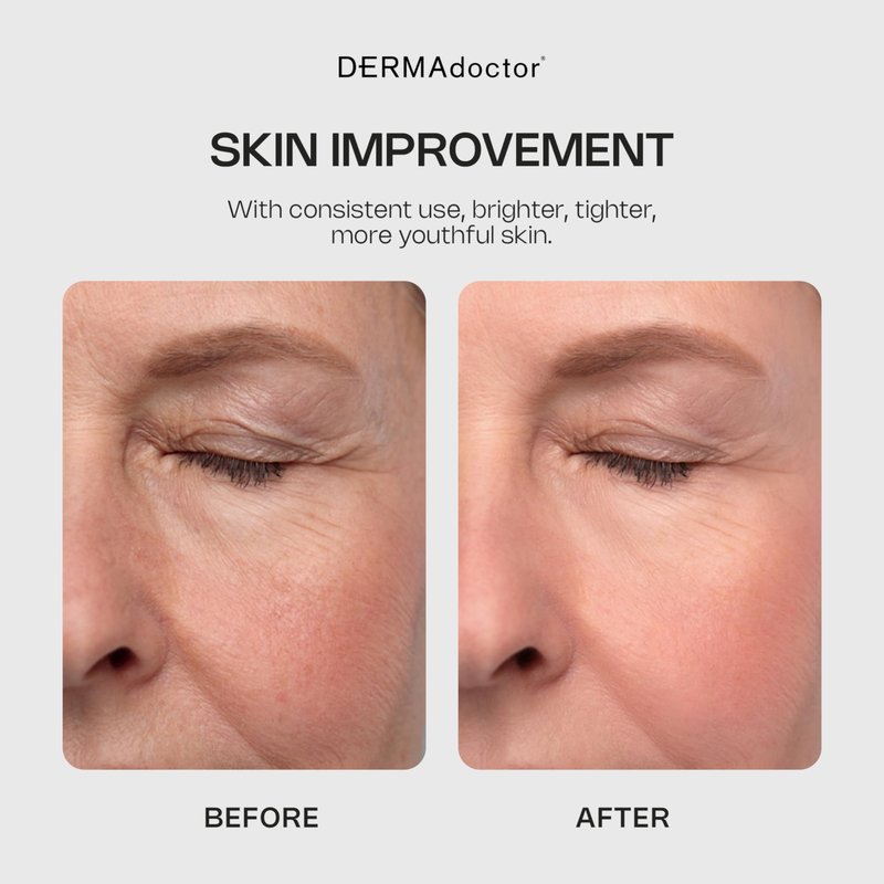 DERMAdoctor Glycolic Acid Face Wash – Exfoliating Face Wash with Antioxidants, Dermatologist Formulated Anti-Aging Facial Cleanser for Fine Lines, Wrinkles, Dullness, Uneven Skin Tone & Enlarged Pores