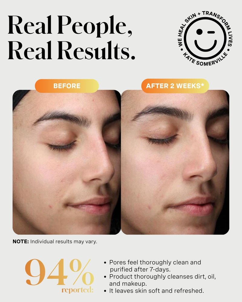 Kate Somerville ExfoliKate Cleanser – Daily Exfoliating Foaming Face Wash, Clinically Formulated Glycolic Acid and Lactic Acid Gentle Facial Scrub, 4 Fl Oz