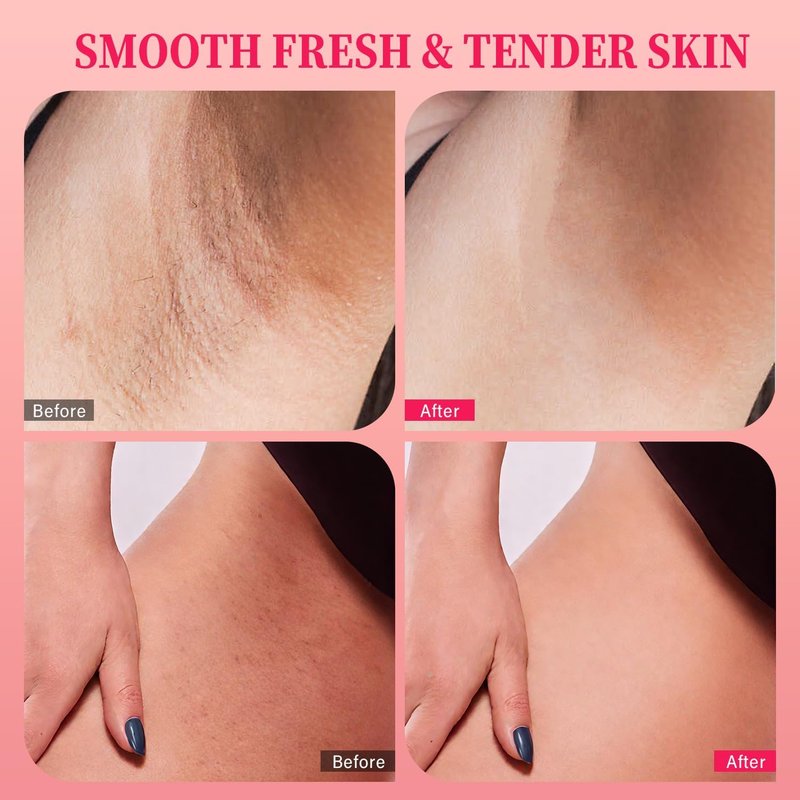 Bikini Area Exfoliator - 10% AHAs, BHA & Vitamin C Scrub for Ingrown Hair & Dark Spots | 7.76 oz