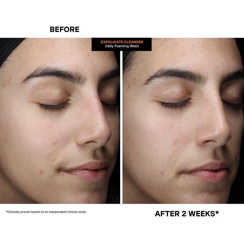 Kate Somerville ExfoliKate Cleanser – Daily Exfoliating Foaming Face Wash, Clinically Formulated Glycolic Acid and Lactic Acid Gentle Facial Scrub, Travel-Size, 1.7 Fl Oz