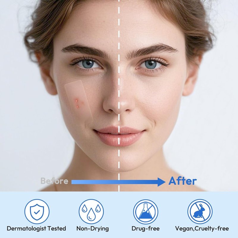 Large Acne Patches - 484 Hydrocolloid Zit Treatment for Face & Body with Tea Tree & Salicylic Acid | XL Size for Forehead, Chin, Neck