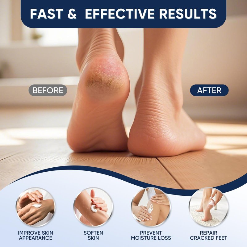 VREKEF Urea Cream 60% with 2% Salicylic Acid, Urea Cream 60 Percent for Feet Maximum Strength, Foot Cream & Callus Remover for Dry Cracked Heels, Rough Thick Skin, Deep Hydration, 5.29 oz