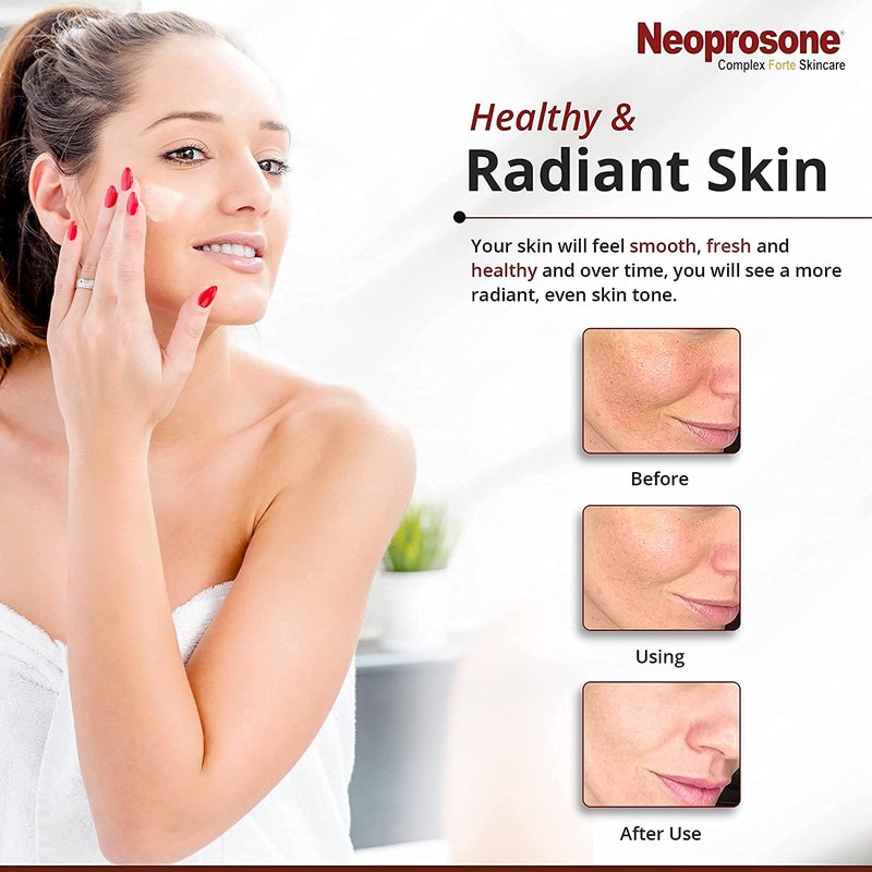 Neoprosone Brightening Body Lotion 400ml - For Dark Spots, Skin Brightening and Anti-Oxidant Properties, with Vitamin c and Alpha Arbutin Complex