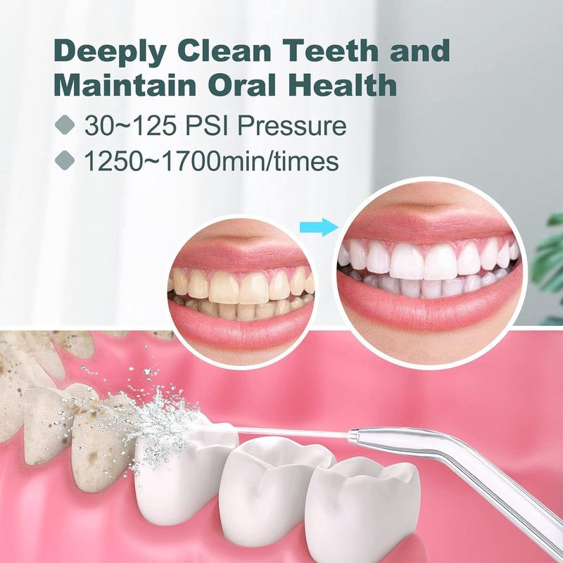 Homuserr Water Flosser, Power Dental Water Flossers for Teeth & Braces Cleaning, Oral Irrigator Electric flosser for Adults & Kids with 10 Pressures & 8 Tips, 600ml Water Flosser for Family