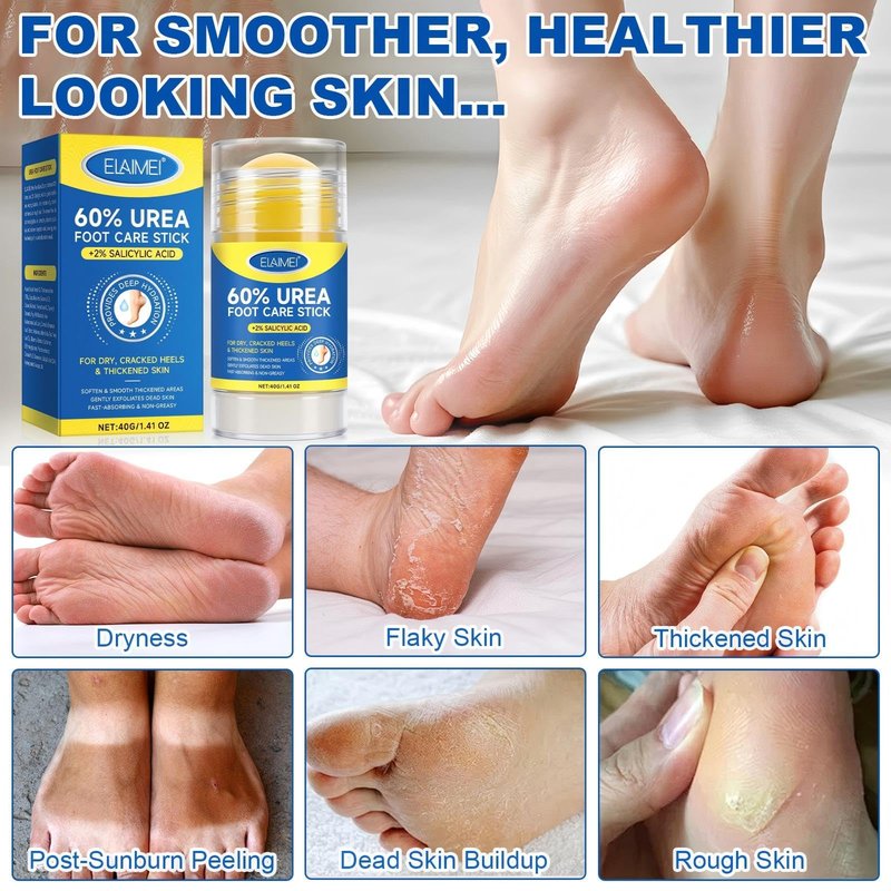 Urea foot Cream Stick 60% plus 2% Salicylic Acid，foot urea cream Deeply Moisturising and Fast Absorbing Gentle Exfoliation For Dry sink Exfoliating Dead Skin, Callus Remover ， Skin Softener