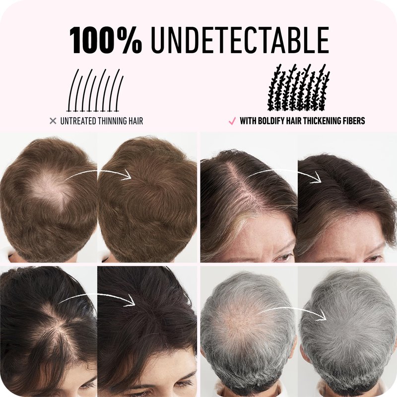 BOLDIFY Hair Fibers (28g) - Fill In Thinning and Fine Hair for an Instantly Fuller, Thicker Look - 14 Shades for Women & Men - Black