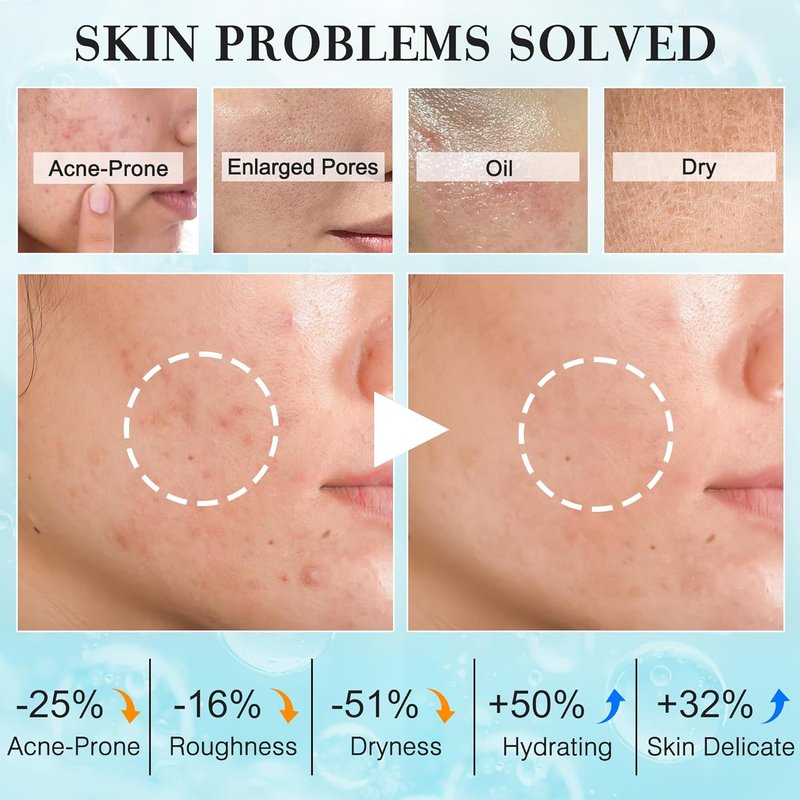 Hydrating Skincare Routine Kit for Teen Girls | Oil Control & Pore Shrinking Travel Size Gift Set
