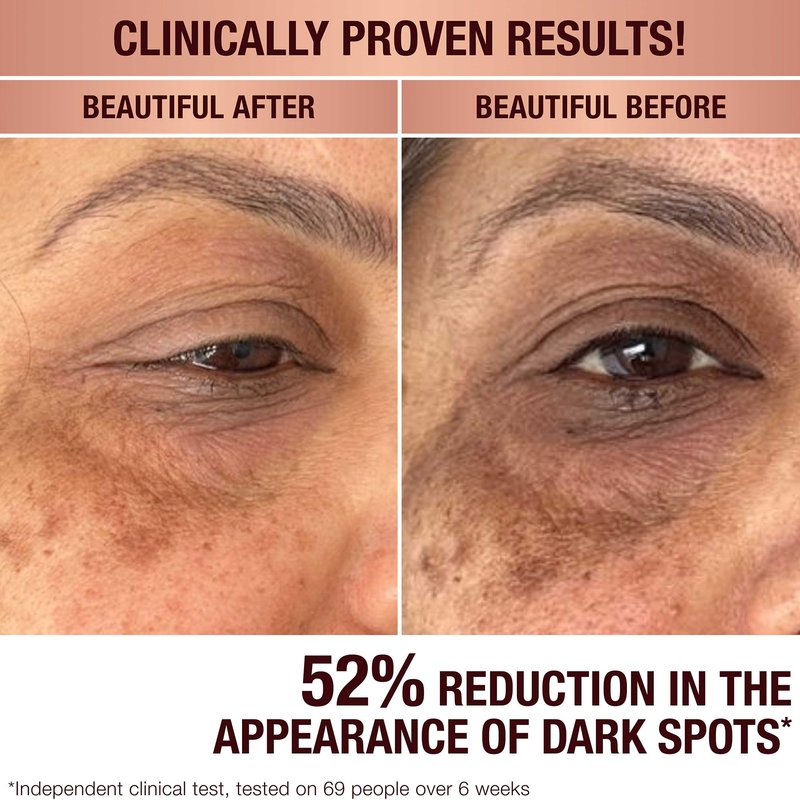 Charlotte Tilbury Radiance Recovery Dark Spot Serum - Tranexamic Acid & Vitamin C Serum for Brighter Looking Under Eyes, Redness, Uneven Skin Tone - Treatment to Reduce Appearance of Aging Skin (10ml)