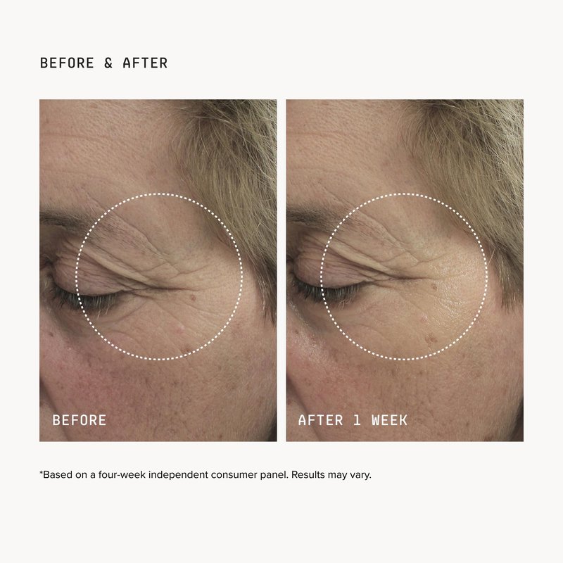 DRMTLGY Brightening Eye Masks – Biodegradable Hydrogel Under Eye Patches with Caffeine, Peptides, Hyaluronic Acid & Niacinamide – Depuff, Hydrate & Smooth Dark Circles