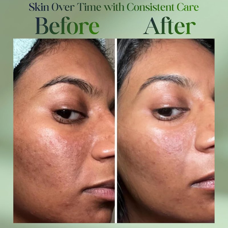 Collagen Retinol Hyaluronic Acid Cream - Anti-Aging Daily Moisturizer for Face & Neck | Lightweight, Fast-Absorbing, 1.7 fl oz