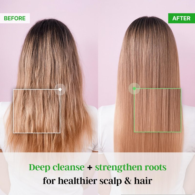 Premium TS Shampoo for Thinning Hair & Hair Loss Care(17.6 Fl Oz) | Best Korea Shampoo | LAVENDER Scent with Essential Oil & Biotin & Natural Ingredients | Men & Women