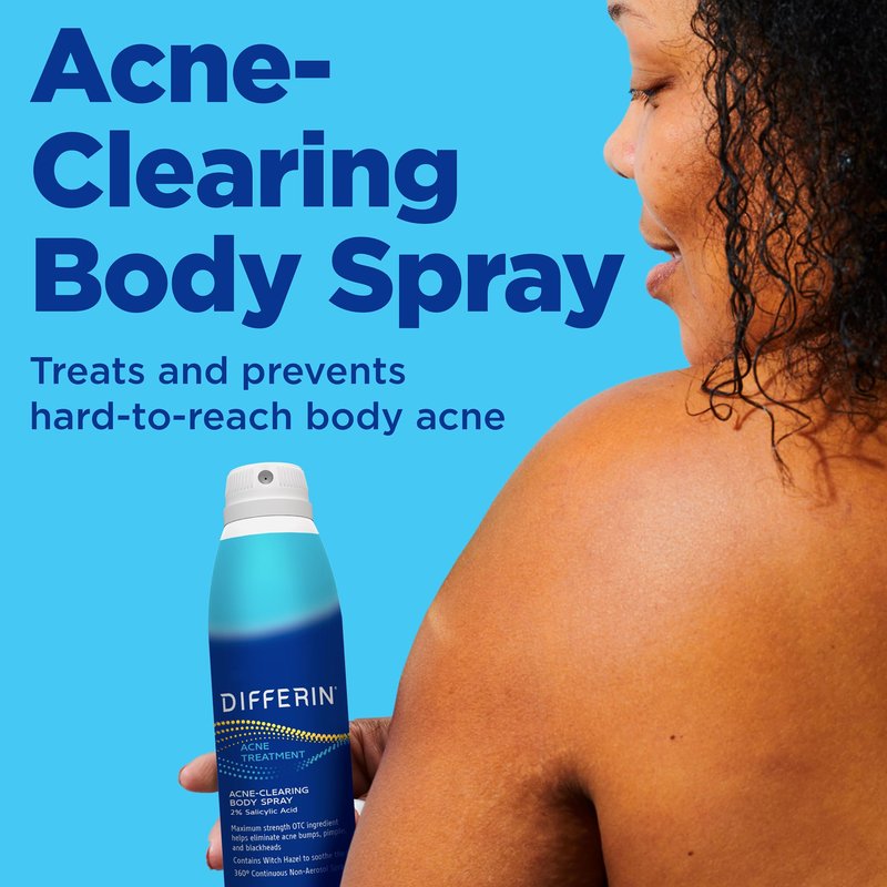 Differin Acne Body Spray, Acne Treatment with Salicylic Acid by the makers of Differin Gel, 360 Formula for Back Acne, Chest and Shoulders, 6 oz